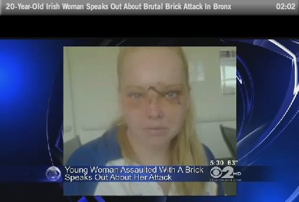 Victim of brick attack
